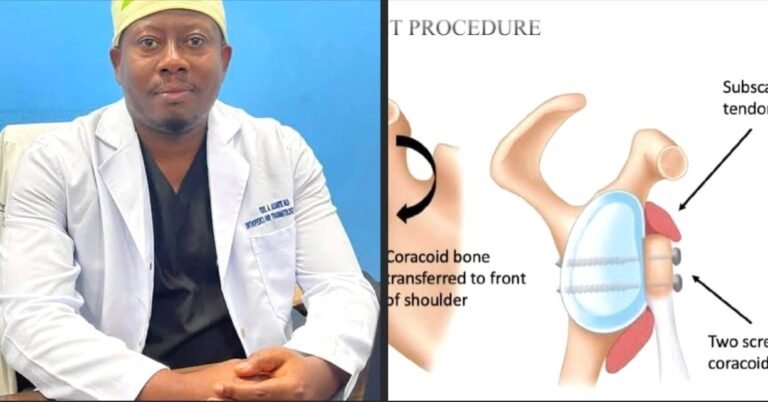 First Successful Advanced Shoulder Surgery Peformed at 14 Military Hospital in Liberia